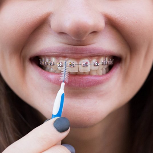 a person brushing their traditional braces in Naperville