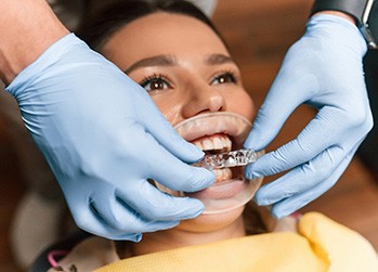 Dentist placing clear aligner on smiling patient