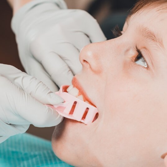 Dentist making a mouthguard