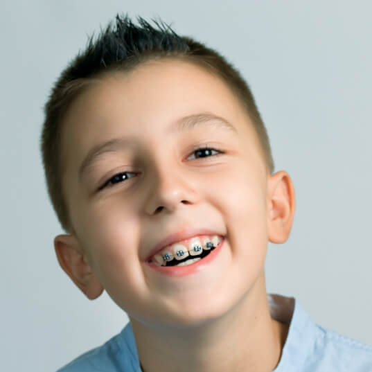 Smiling child with orthodontic appliance