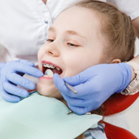 Child with braces looking in the mirror and smiling