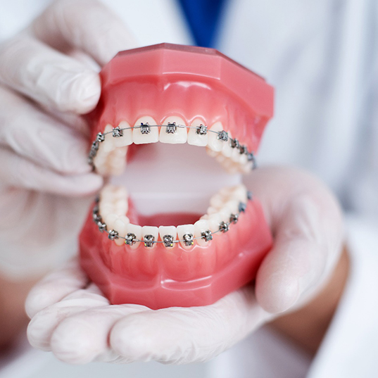 An orthodontist holding a mock jaw with traditional braces