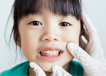 a child with crooked teeth in Naperville