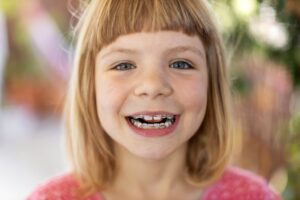 Child with braces smiling. 